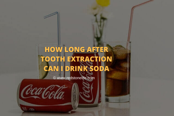 Find Out: How Long After Tooth Extraction Can I Drink Soda