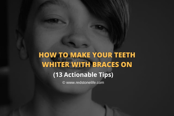 how-to-make-your-teeth-whiter-with-braces-on-13-tips