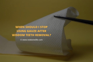 after wisdom teeth removal do i sleep with gauze