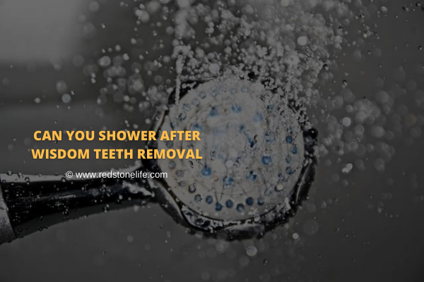 Can You Shower After Wisdom Teeth Removal? - FIND OUT!
